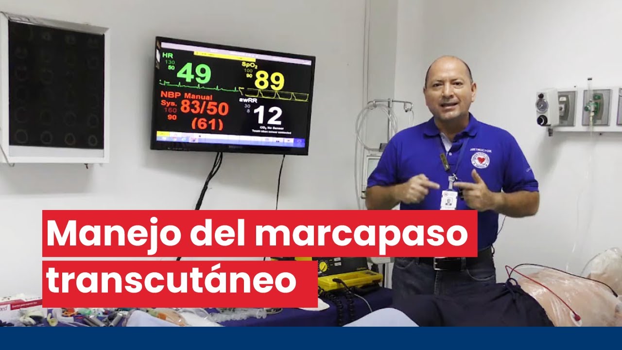 Manejo del marcapaso transcutáneo