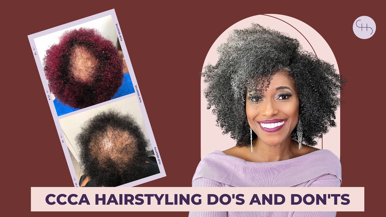 CCCA ALOPECIA HAIRSTYLES DO'S AND DON'TS (PART 1)