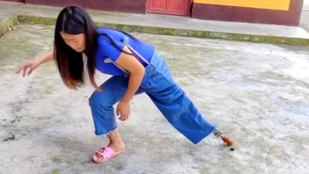 Hip Amputee Girl Using Crutches From Inside Her Empty Pant Leg | One Leg Woman