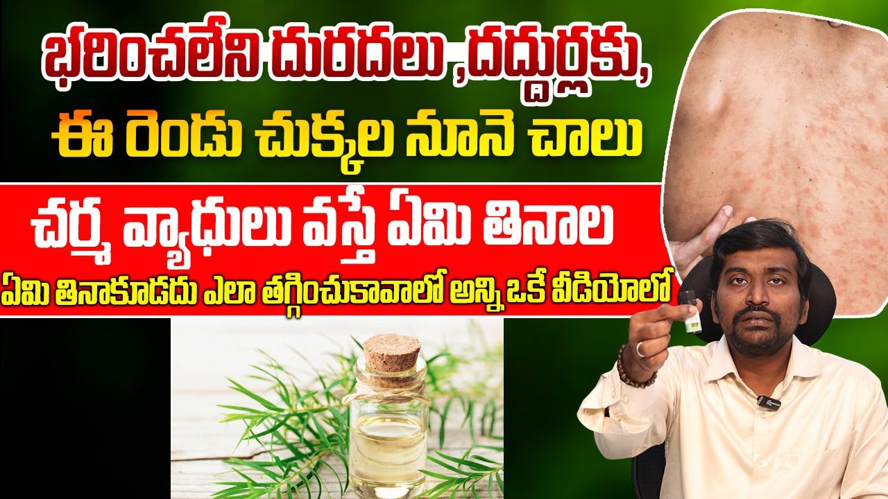 భరించలేని దురదలు ,దద్దుర్లకు, ఈ రెండు చుక్కల నూనె చాలు | Natural Remedies & Diet for Skin Itching