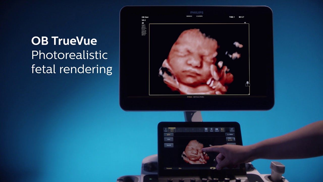 The all new Philips EPIQ ELITE