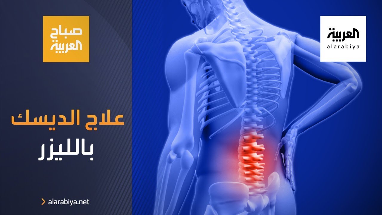 صباح العربية | أحدث علاجات آلام الديسك بدون جراحة باستخدام الليزر