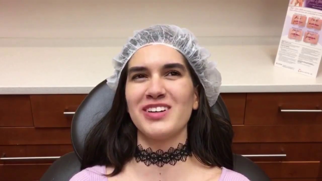 Lip Fillers by Dr. Valaie, MD - Newport Beach, Orange County, CA