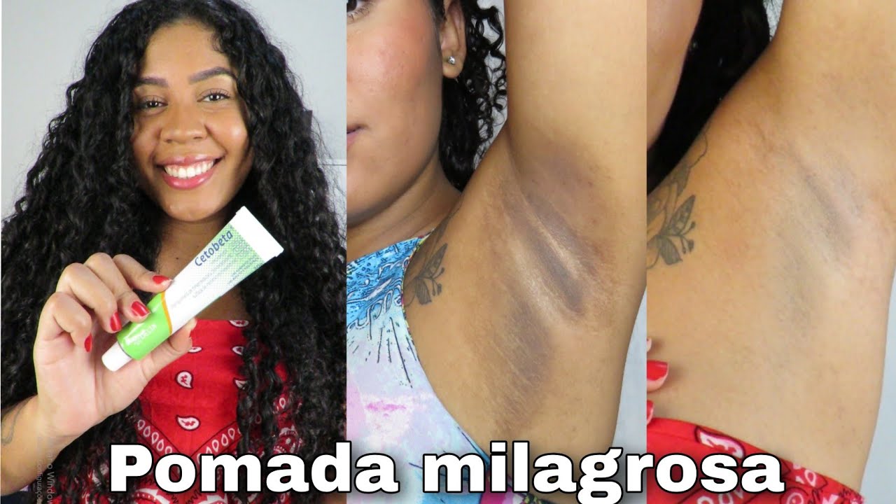 COMO CLAREAR AS AXILAS EM CASA *POMADA MILAGROSA PARA AS AXILAS E VIRILHA* #2