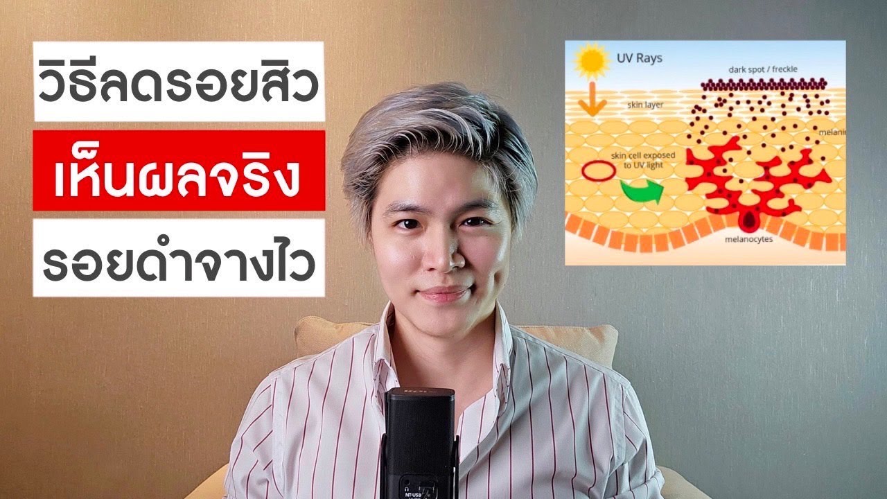 ลดรอยสิว จุดด่างดำยังไง?? เห็นผลจริง รอยดำจางไว