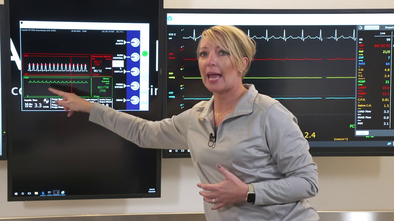 What the Automated Impella Controller (AIC) is Displaying