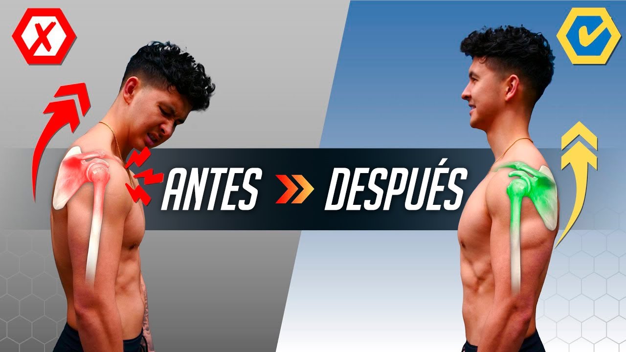 Cómo enderezar los hombros en 10 minutos (¡PARA SIEMPRE!) 💪