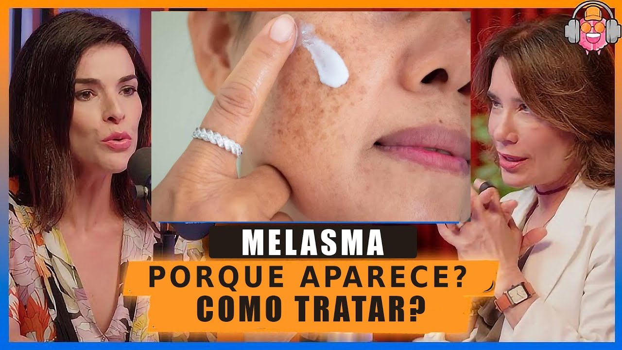 A Melhor explica&ccedil;&atilde;o sobre Mancha no Rosto de MELASMA, como aparece e como tratar?