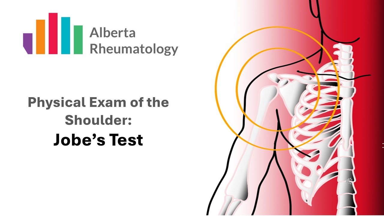 Jobe's Test or Empty Can Test: Rheumatology Shoulder Physical Exam Special Tests
