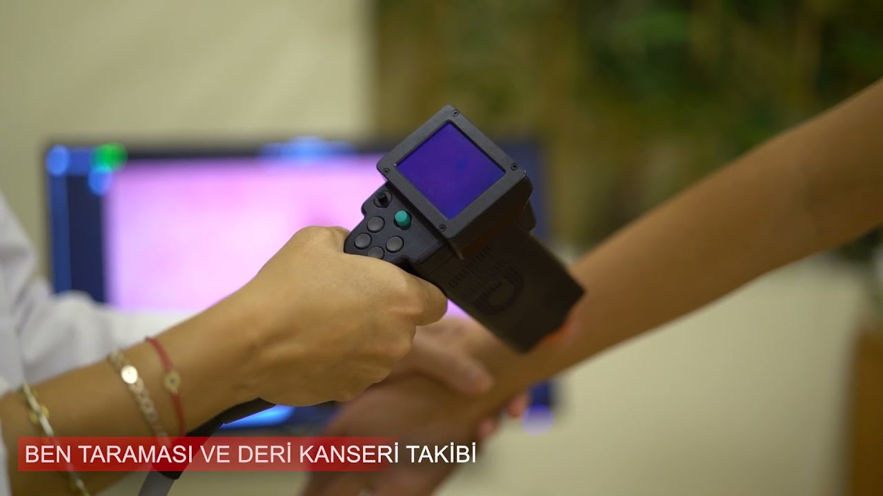 Ben Taraması ve Deri Kanseri Takibi - Prof. Dr. Emel Güngör