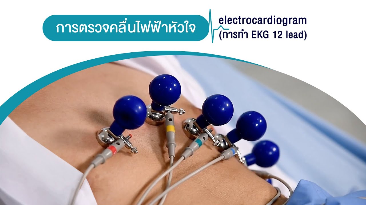 การตรวจคลื่นไฟฟ้าหัวใจ electrocardiogram
