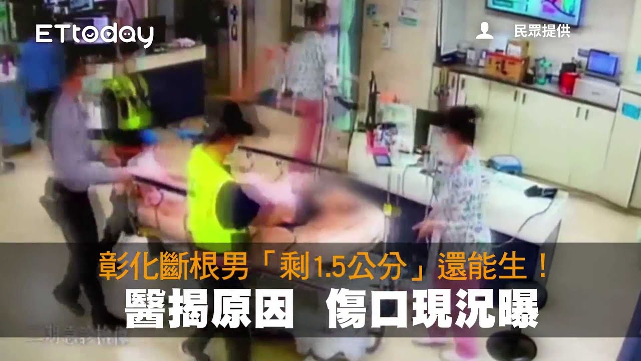 彰化斷根男「剩1.5公分」還能生！醫揭原因　傷口現況曝
