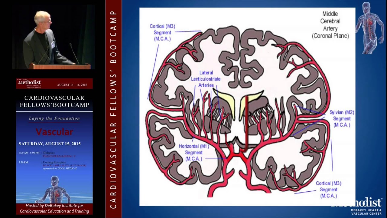 Neurovascular Anatomy, Physiology, and Carotid Imaging (John Eidt, MD)
