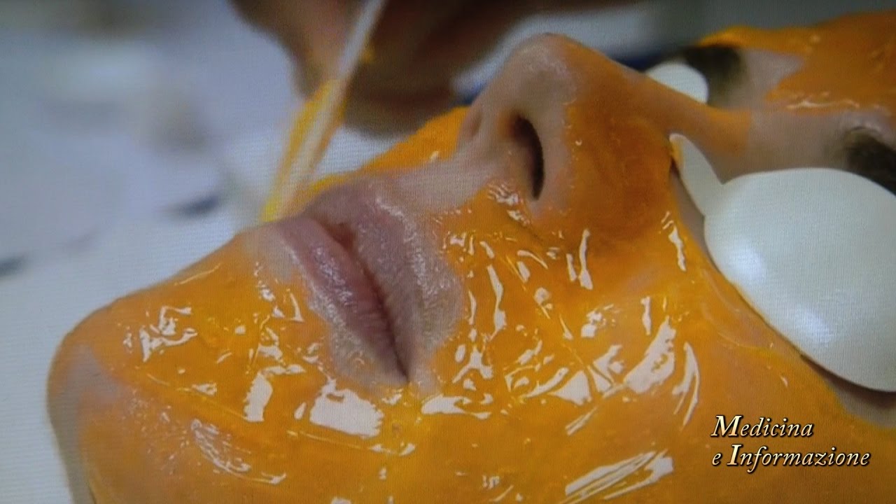 Nuova Tecnologia Biofotonica per la cura dell'Acne