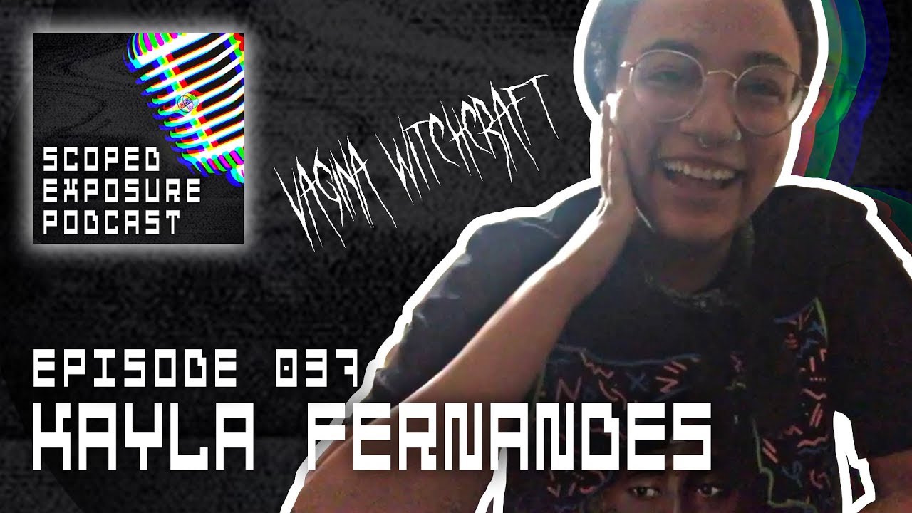 Kayla Fernandes [VAGINA WITCHCRAFT] - Scoped Exposure Podcast 037