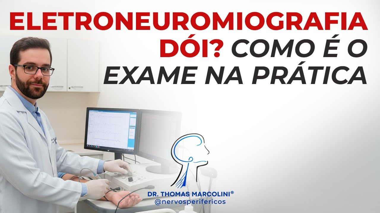 Eletroneuromiografia D&oacute;i Muito? Entenda tudo aqui!