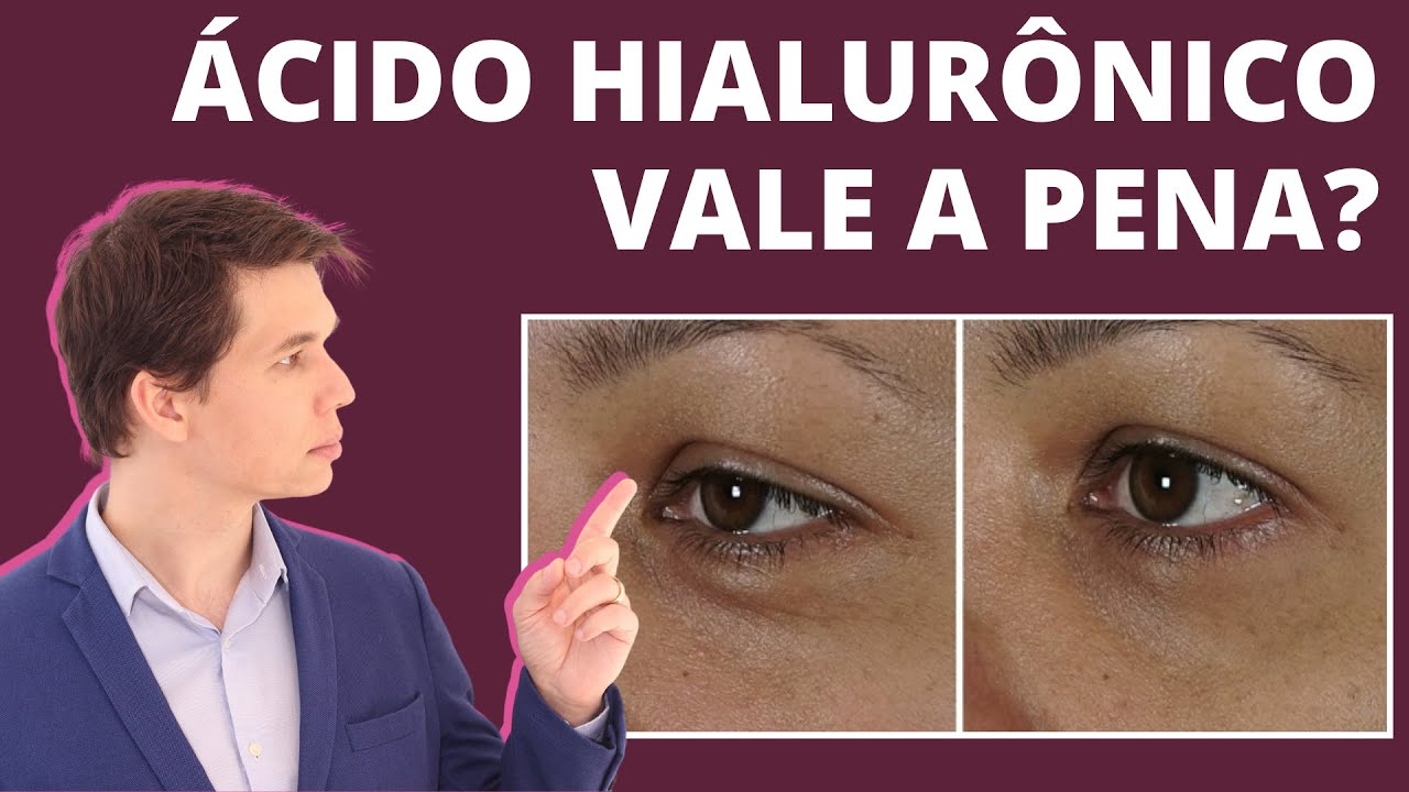 Ácido Hialurônico FUNCIONA na pele? Hidratação Preenchimento