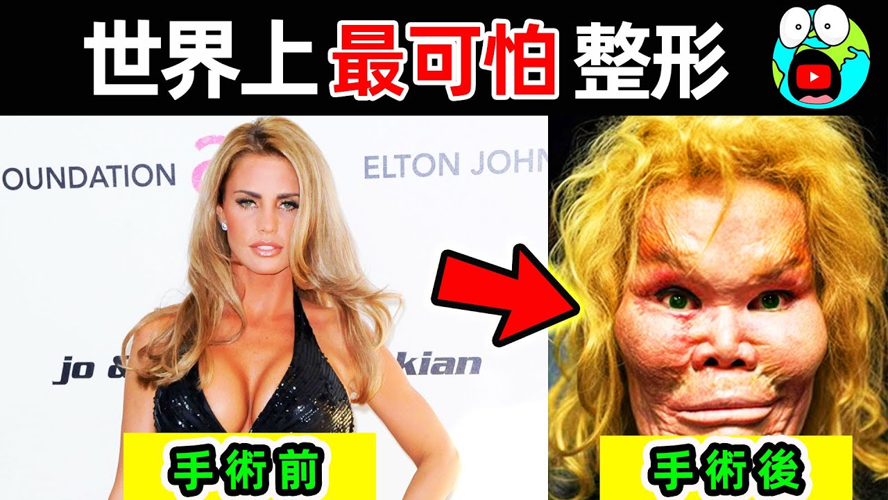 世界上最可怕的整形失敗！第一名男友當場嚇尿，10個被&ldquo;過度整形&rdquo;的明星人物。|#地球十大 #世界之最top #世界之最 #地球之最 #腦洞大開 #出類拔萃 #top10 #最可怕整形 #整形失敗