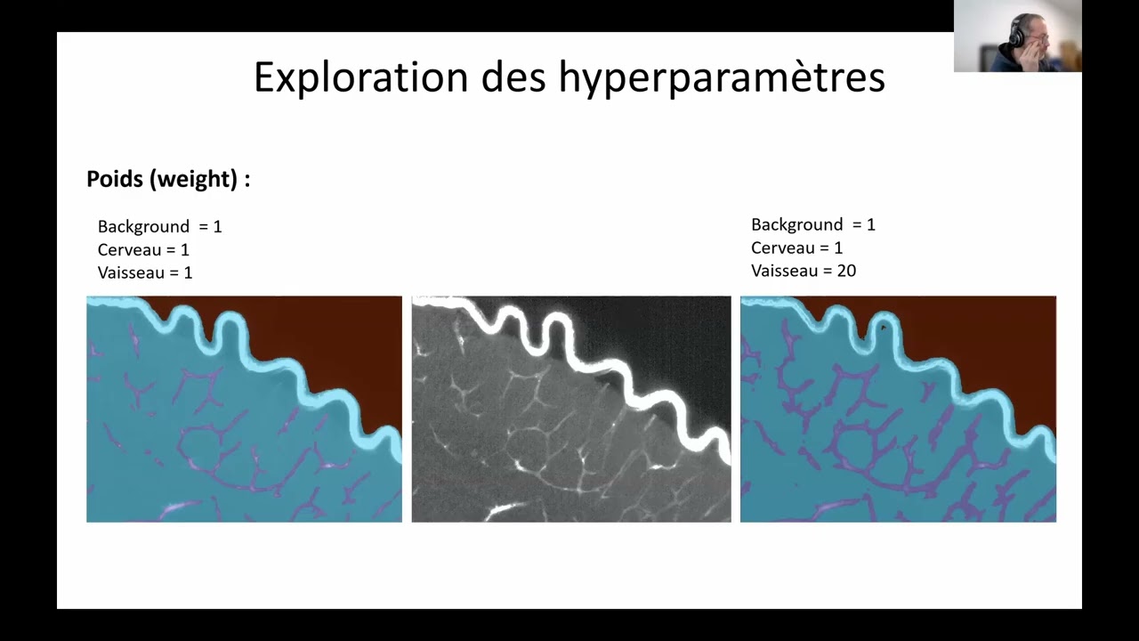 Segmentation 3D de vaisseaux sanguin en lightsheet par un modèle U-net et approche 