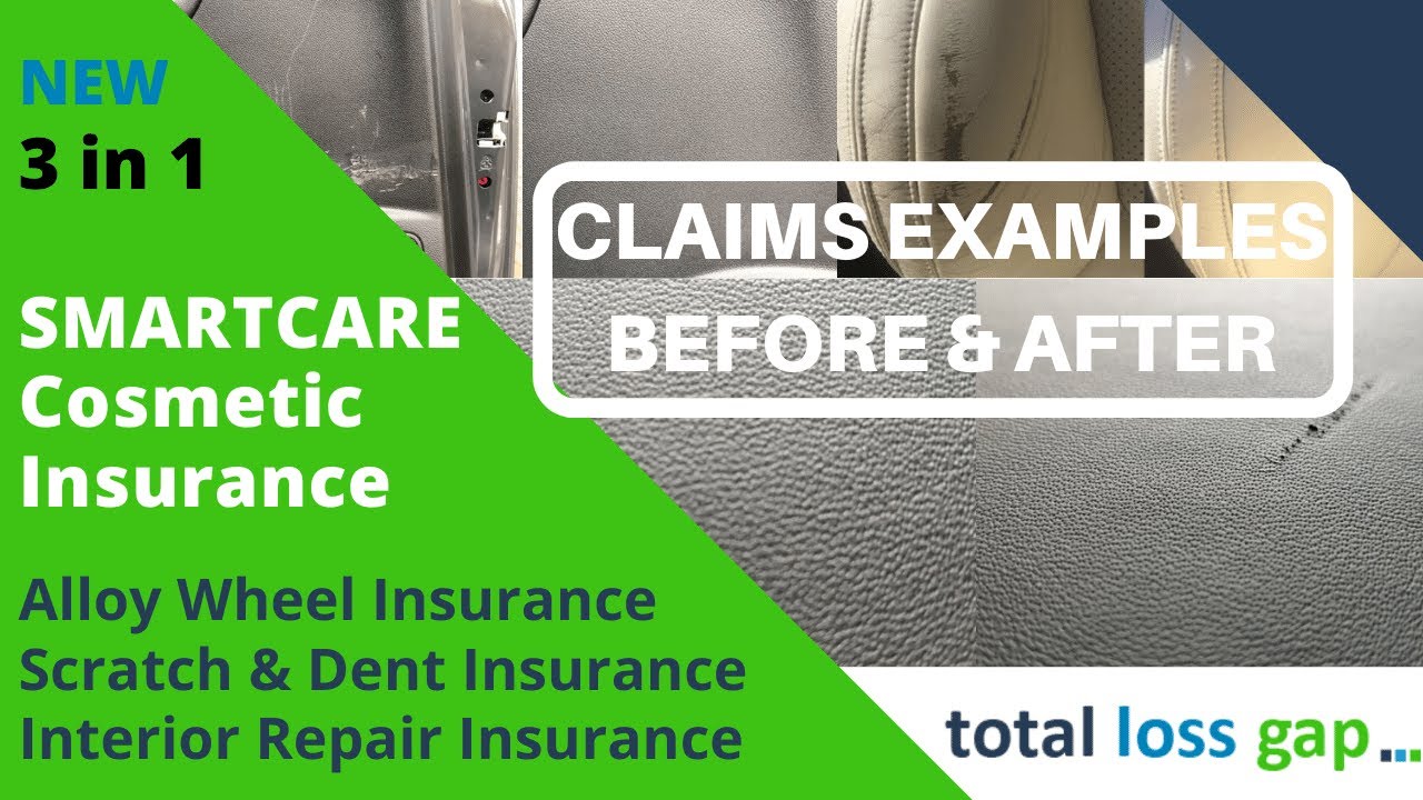 SMARTCare interior repairs 'before and after' from Total Loss Gap