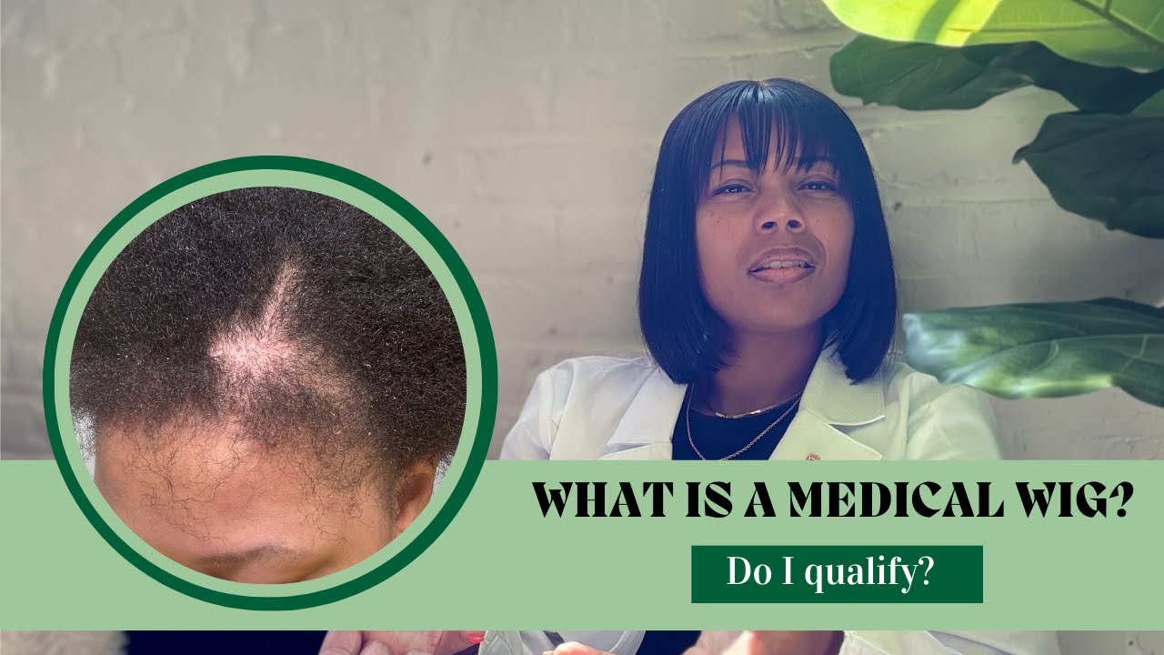 What Is A Medical Wig ? | Do I Qualify For A Medical Wig?
