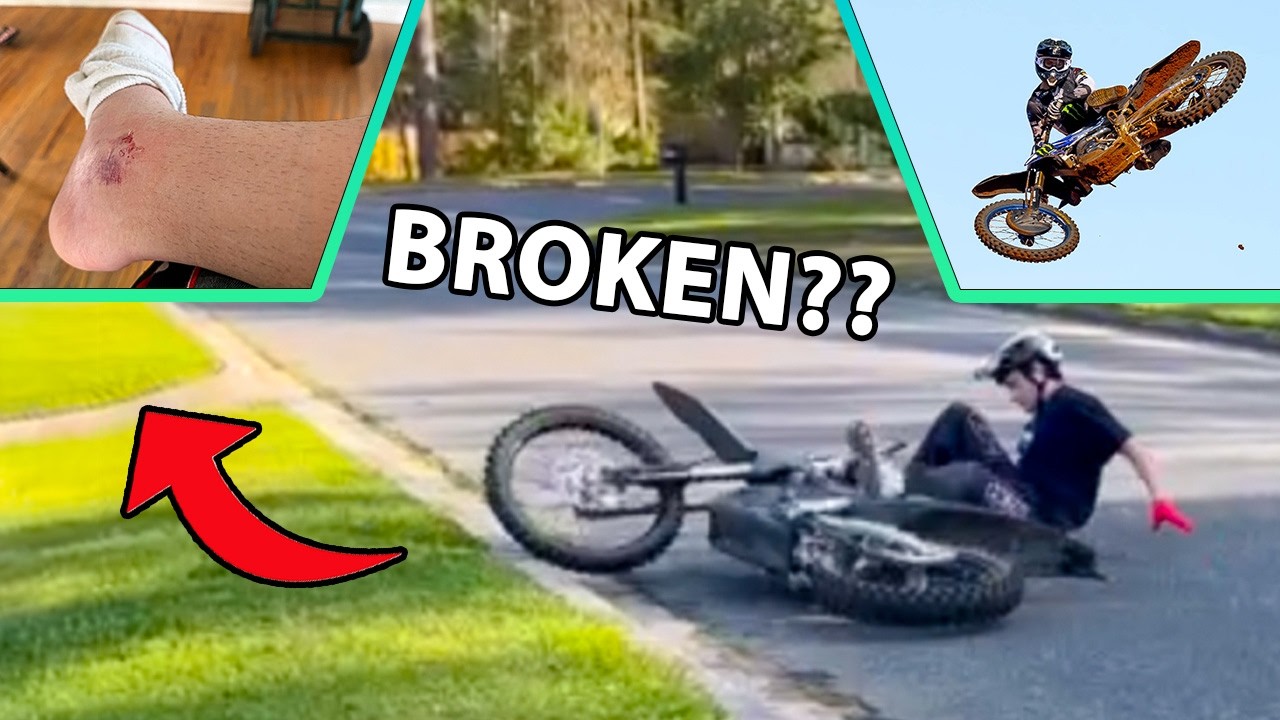 Broken Ankle? Compound Supercross!