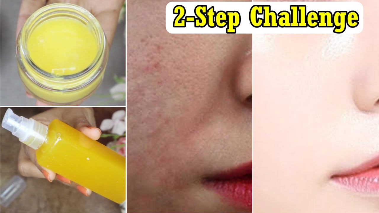 Glass Skin Challenge- 2 Steps-7 Days-चमकेगी Skin साफ होगी रंगत- Dull Skin Pigmentation-झाईयां Clear