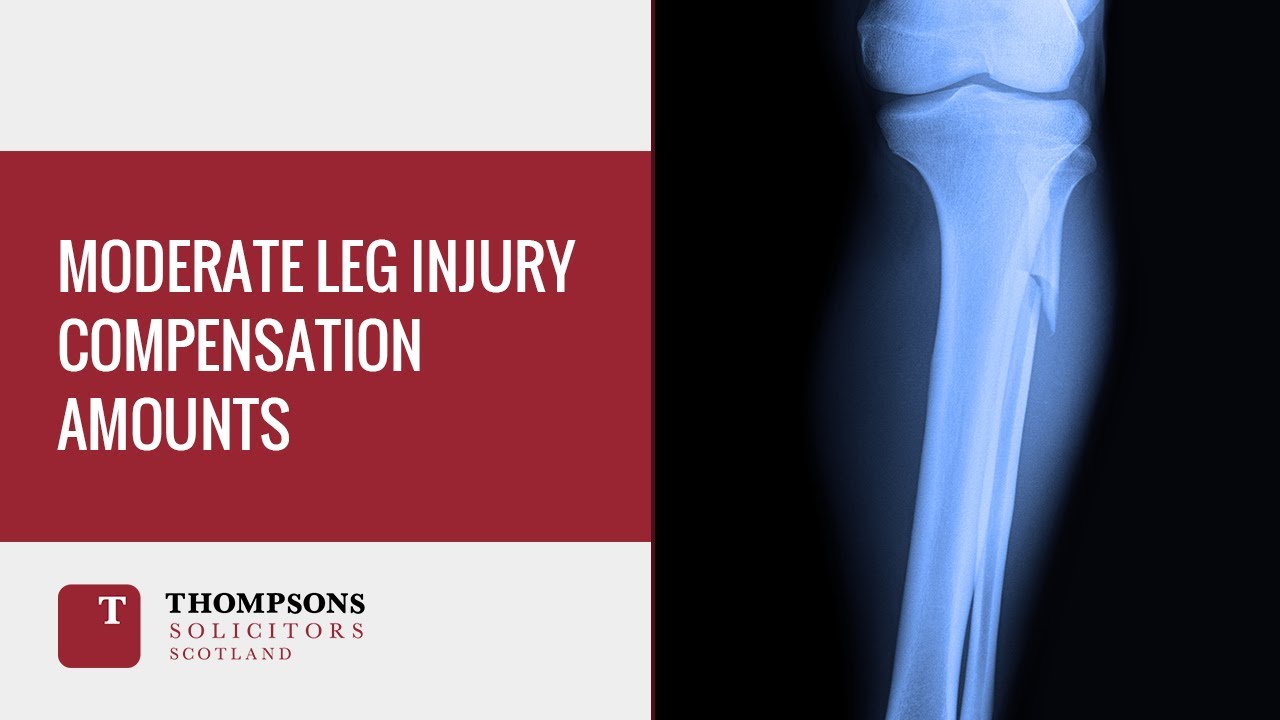 Moderate Leg Injury Compensation Amounts