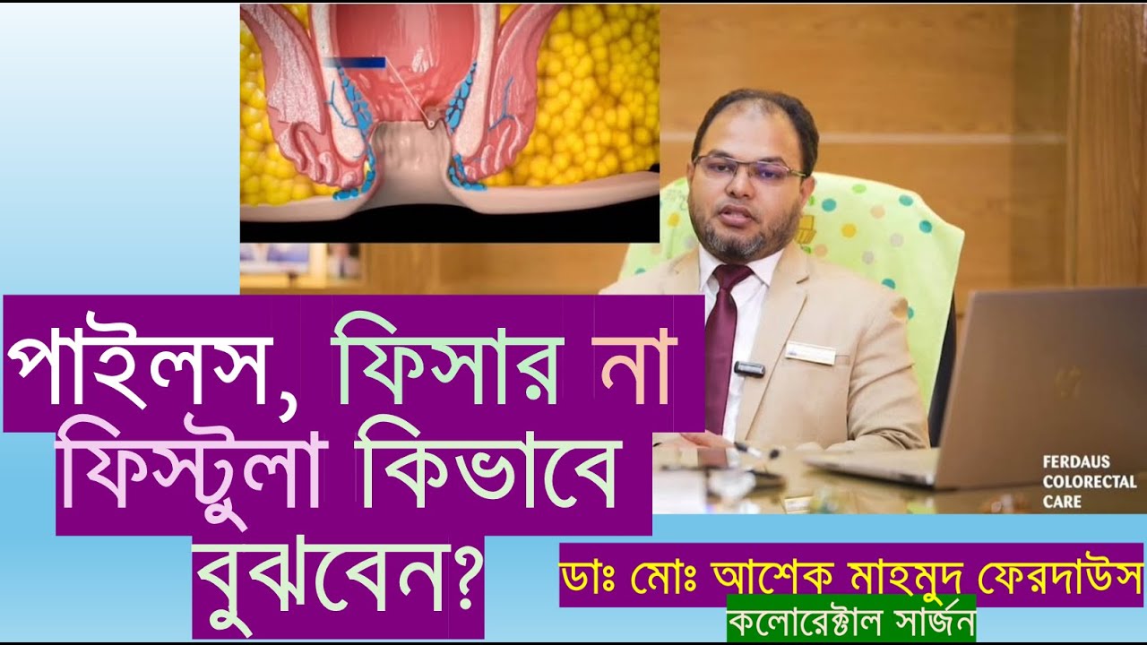  পাইলস, ফিসার নাকি ফিস্টুলা হয়েছে কিভাবে বুঝবেন?#piles #fissure #fistula #pilestreatment 
