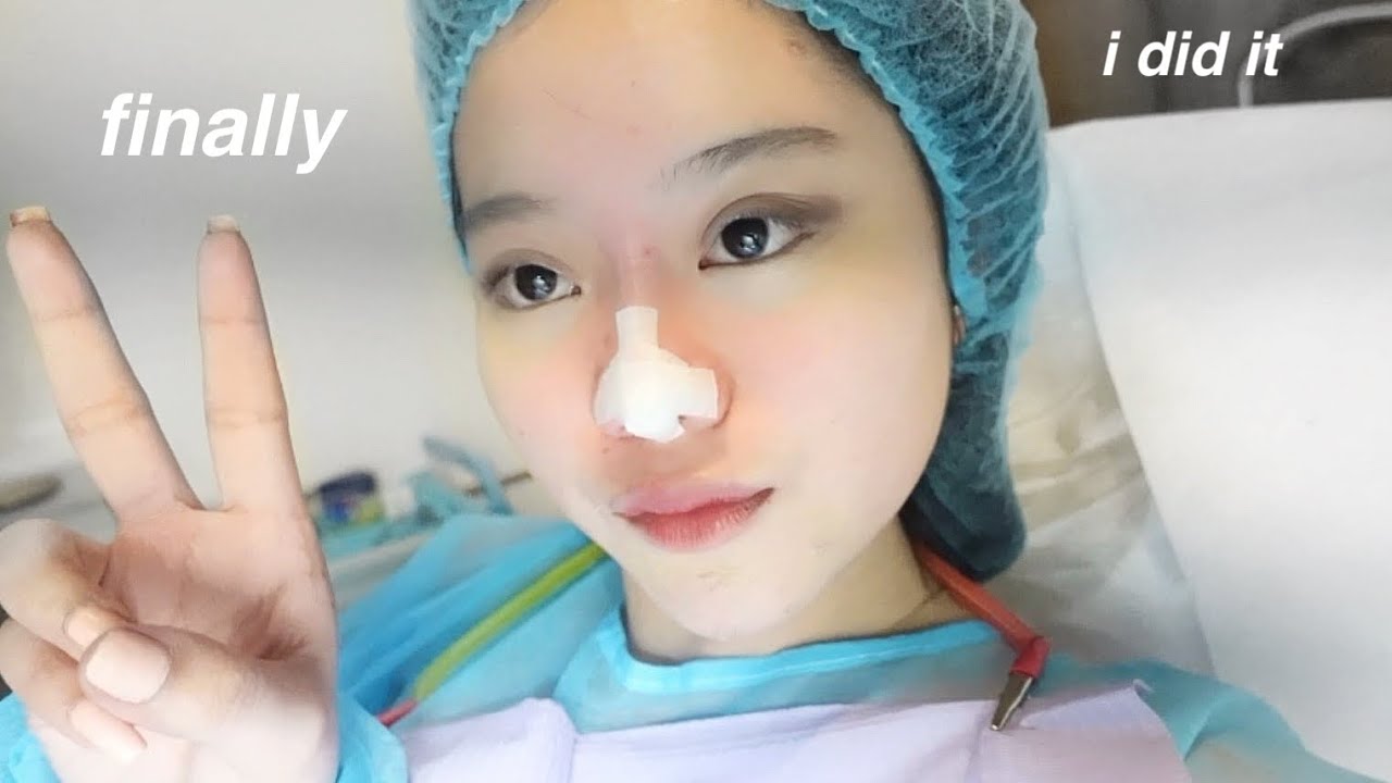 I GOT A NOSE JOB! *finally*