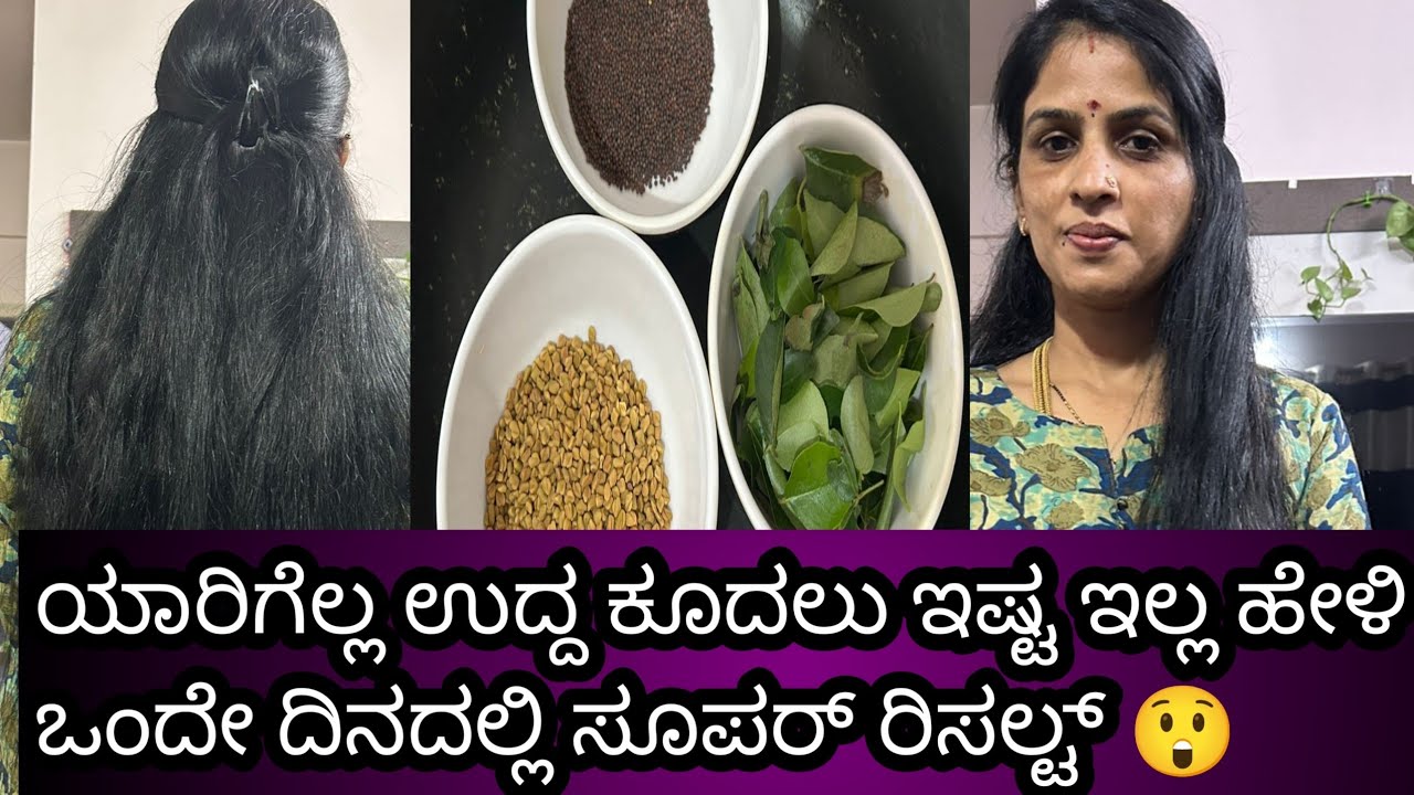 ನಿಮಗೆ ಹೇರ್ ಫಾಲ್ ಆಗ್ತಿದ್ಯಾ. ಡ್ಯಾಂಡ್ರಫ್ ಇದಿಯಾ. ಕೂದಲು ಬೆಳಿತಿಲ್ವಾ. 😲 ಒಂದೇ ದಿನದಲ್ಲಿ  #tips  #kudalu