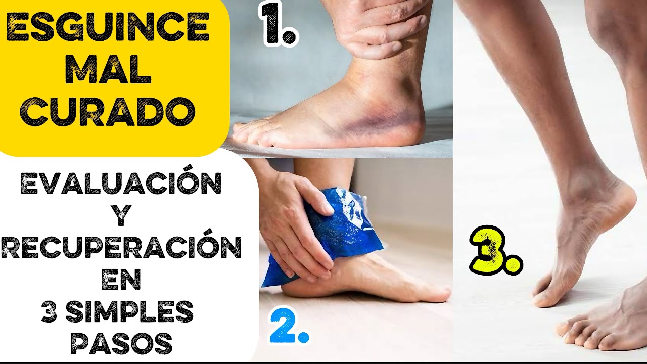 ESGUINCE de TOBILLO mal CURADO (Crónico)//EVALUACION y RECUPERACIÓN casera en 3 pasos//Video #11