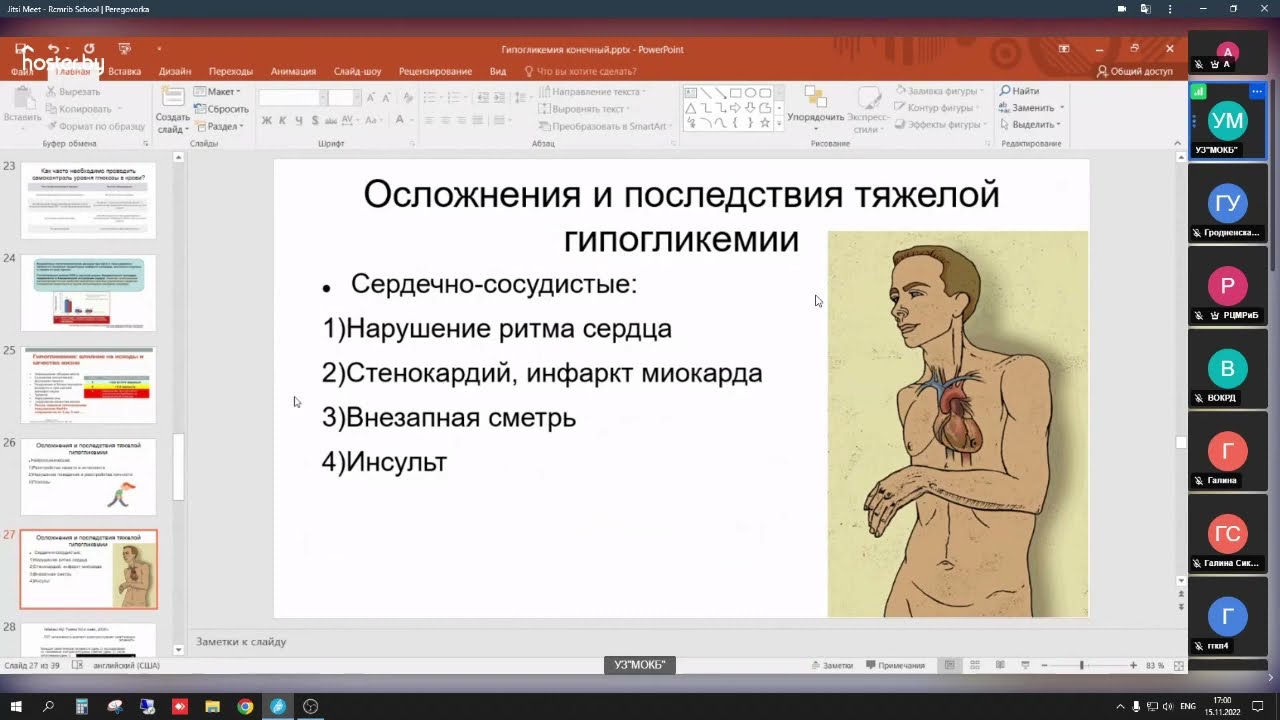 Неотложные состояния при сахарном диабете 1 типа