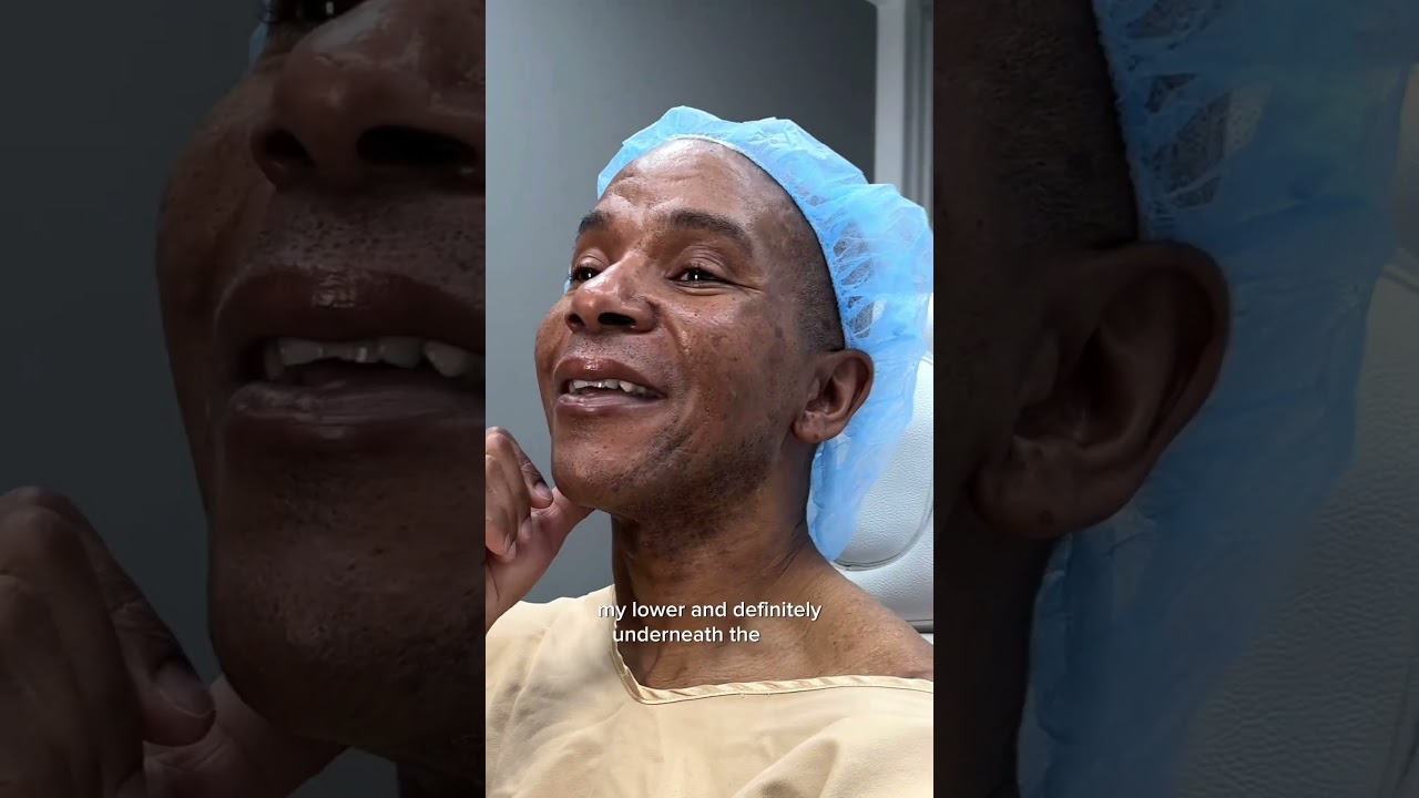 MEN GET PLASTIC SURGERY TOO! Male Facelift Patient Shares His Transformation 😱
