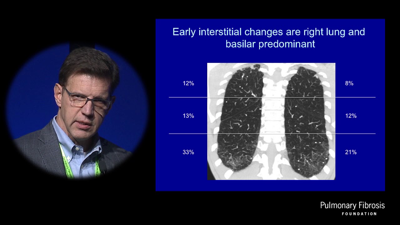 Lessons from At-Risk Cohorts | Tim Blackwell, MD