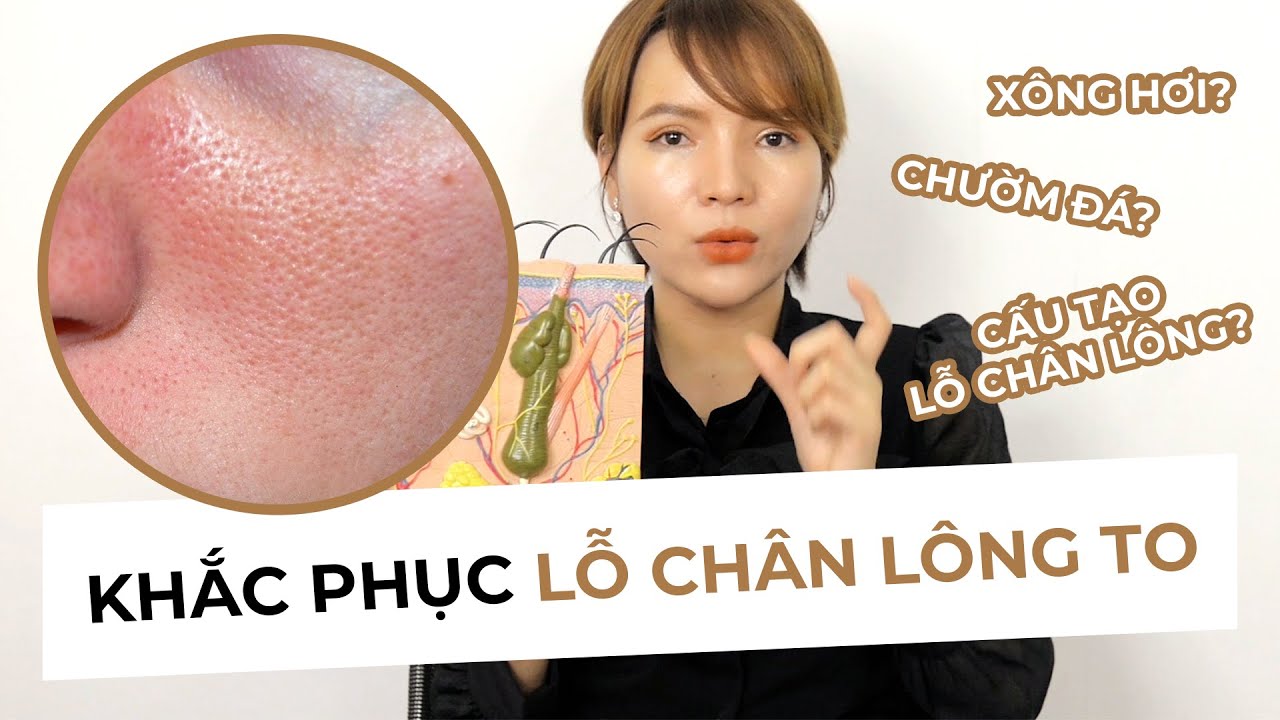 KHẮC PHỤC LỖ CHÂN LÔNG TO - Đầy đủ kiến thức từ cấu trúc, cách khắc phục, sai lầm thường gặp.