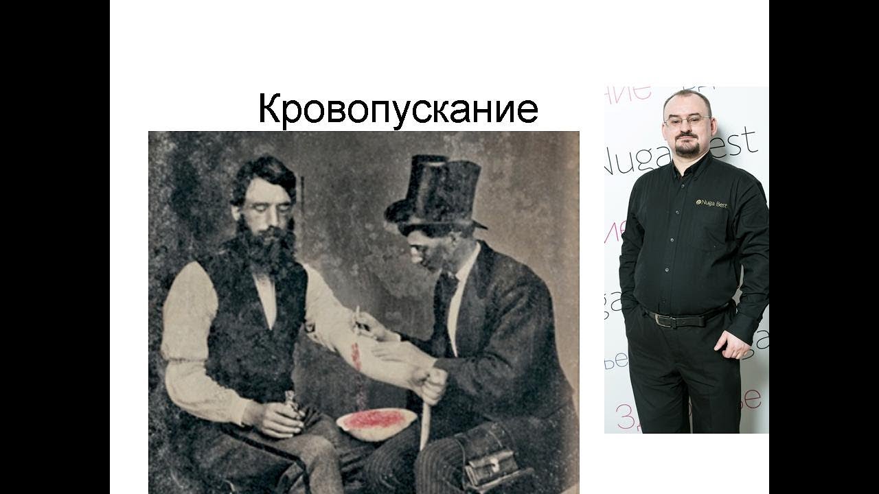 Кровопускание, как старинная методика лечения гипертонии