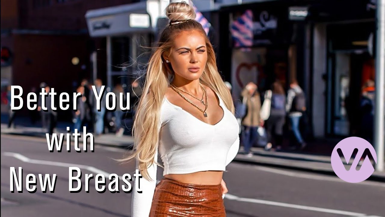 Tetyana's New Breasts | Breast Augmentation at Vanity #breastaugmentation