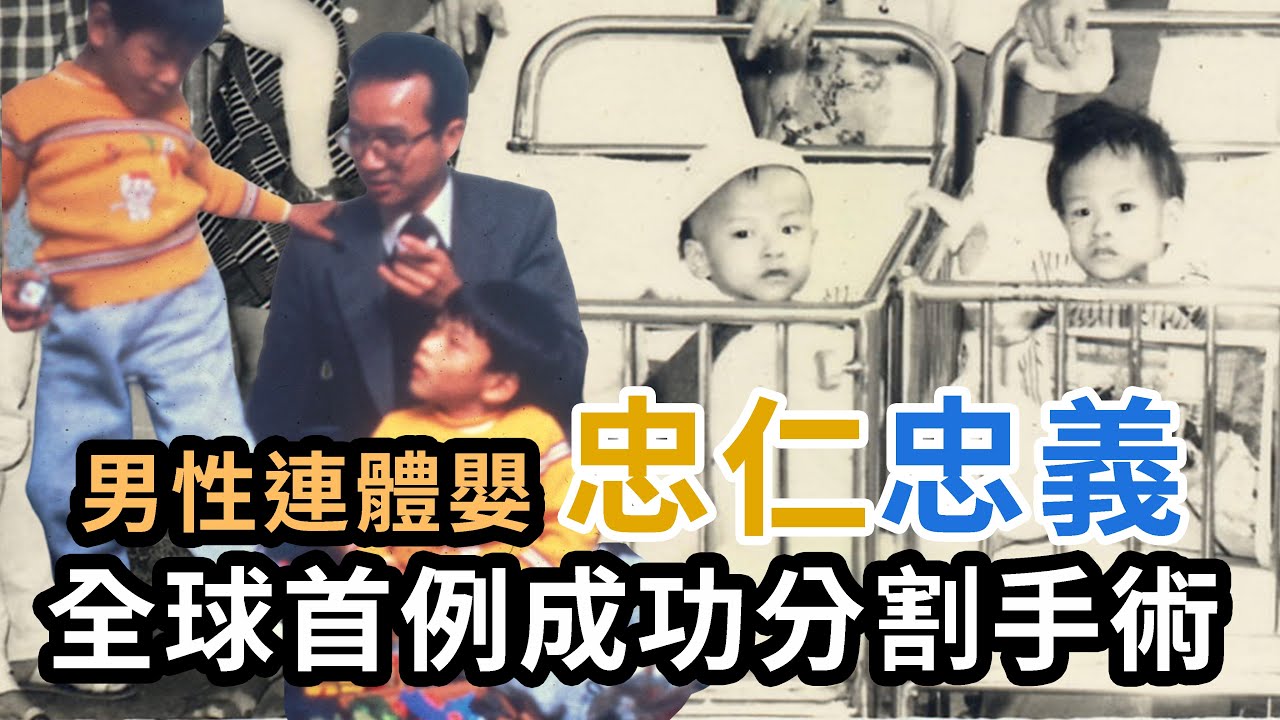 忠仁、忠義連體嬰, 全球首例男性成功分割手術｜凡事豫則立, 不豫則廢｜陳維昭校長的故事EP06