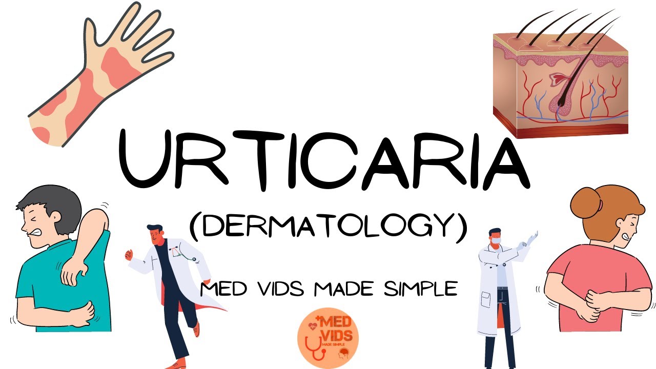 Крапивница | Дерматология (патофизиология, клиника, диагностика, лечение) MedVidsMadeSimple