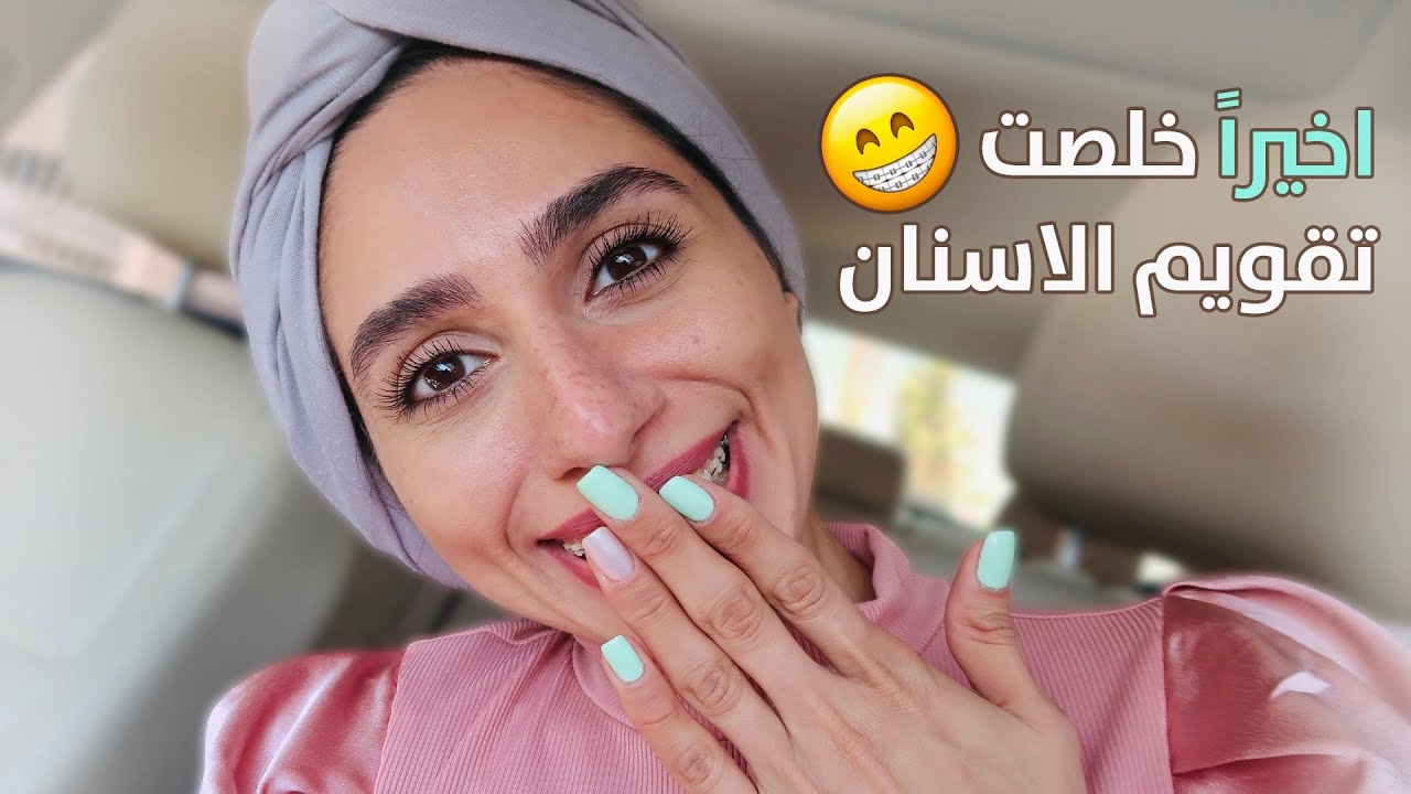 و اخيرا شلت التقويم ! شوفوا شكل اسناني