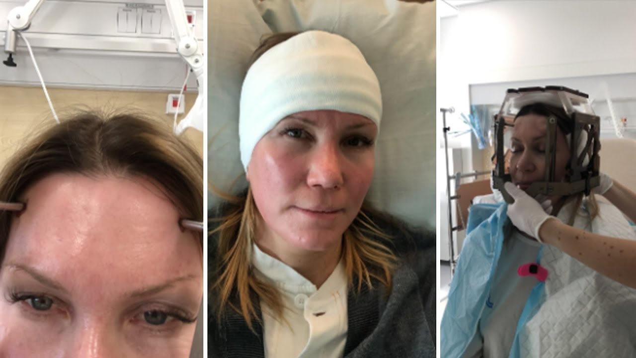 Fem år sedan Jenny Alversjö drabbades av stroke: ”Det sa pang” | Efter fem | TV4 & TV4 Play