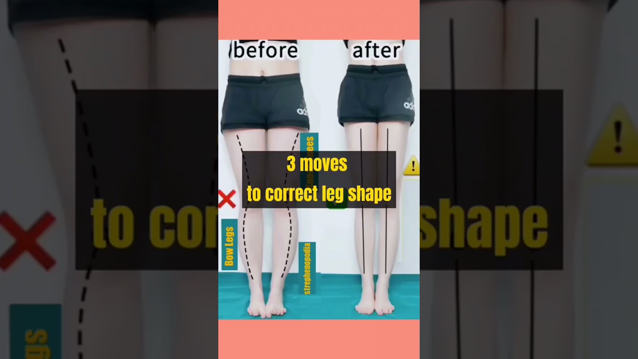 3 moves to correct leg shape #physiofitness