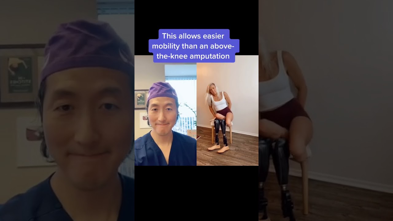 Plastic Surgeon Reacts to Leg Prostheses #shorts #amputation