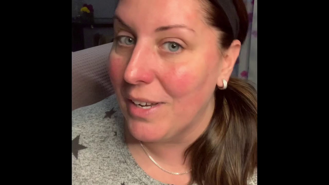 Lifting with the Leaf facial demo