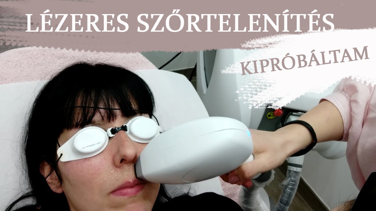 LÉZERES SZŐRTELENÍTÉS - KIPRÓBÁLTAM Fáj? Mennyibe kerül? Hogy működik? Mire kell vigyázni? KUPONNAL