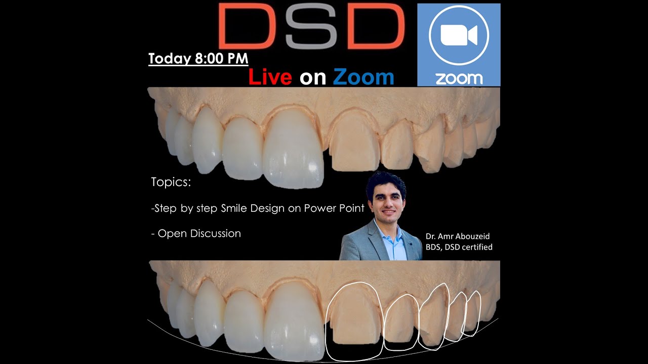 Digital Smile Design on Power Point By Dr. Amr Abouzeid (in Arabic)