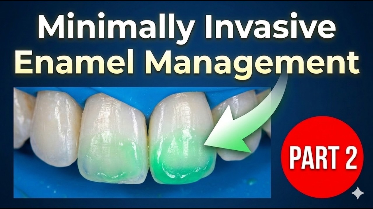 Minimally Invasive Enamel Management - Part 2/2