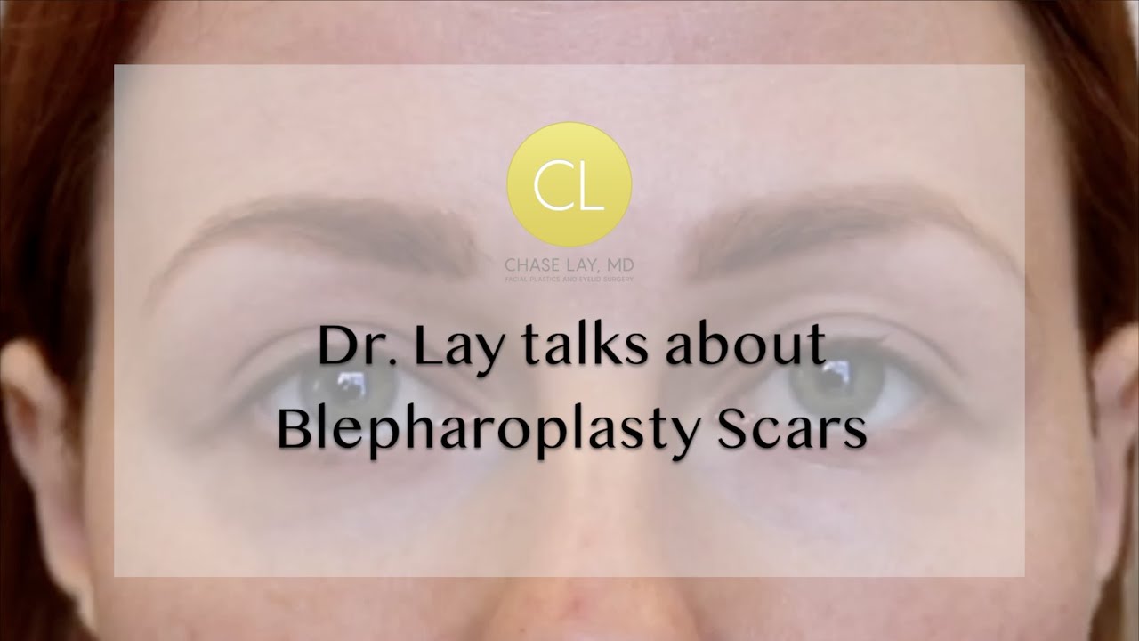 Best and Worst Blepharoplasty Scars with Chase Lay MD