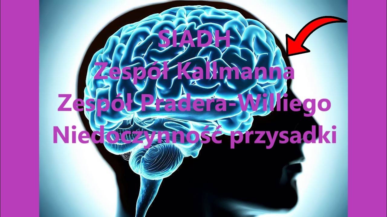 Endokrynologia [cz.2] SIADH/Zesp&oacute;ł Kallmanna/Zesp&oacute;ł Pradera-Williego/Niedoczynność przysadki